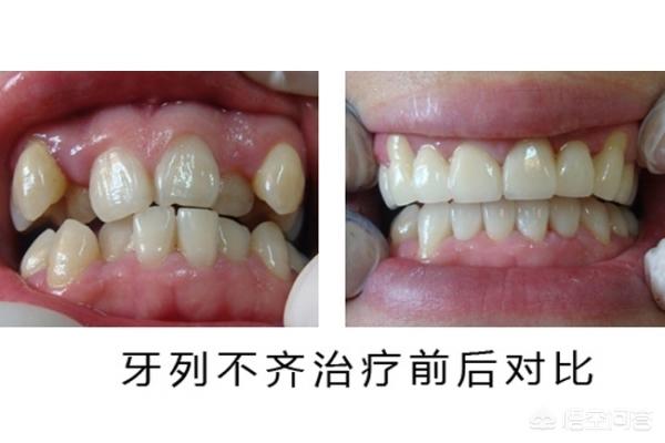 昭通最新24小时牙医在线咨询方法分析(最方便真实的昭通有没有24小时牙医方法)