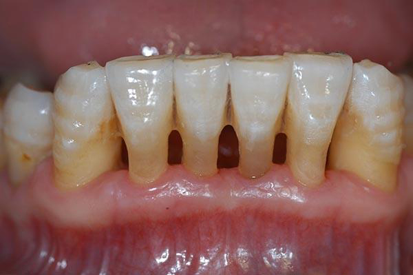 昭通最新24小时牙医在线咨询方法分析(最方便真实的昭通有没有24小时牙医方法)